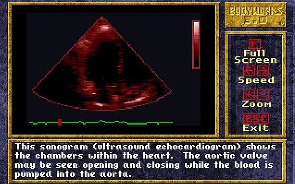 Bodyworks 3.0 on MS-DOS 7.10: Videos - Beating heart (sonogram)